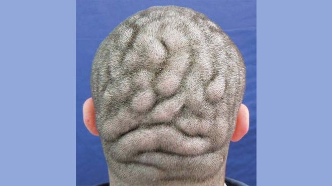 Brain Scalp Final.jpg